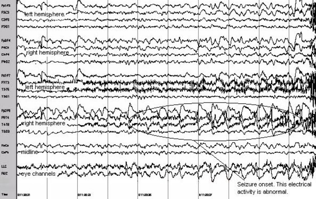 EEG - Gippsland Specialists Clinic
